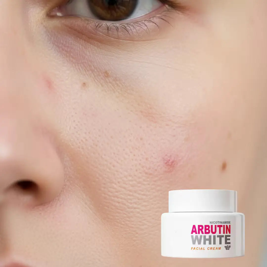 Arbutin White - Crema Aclarante Facial