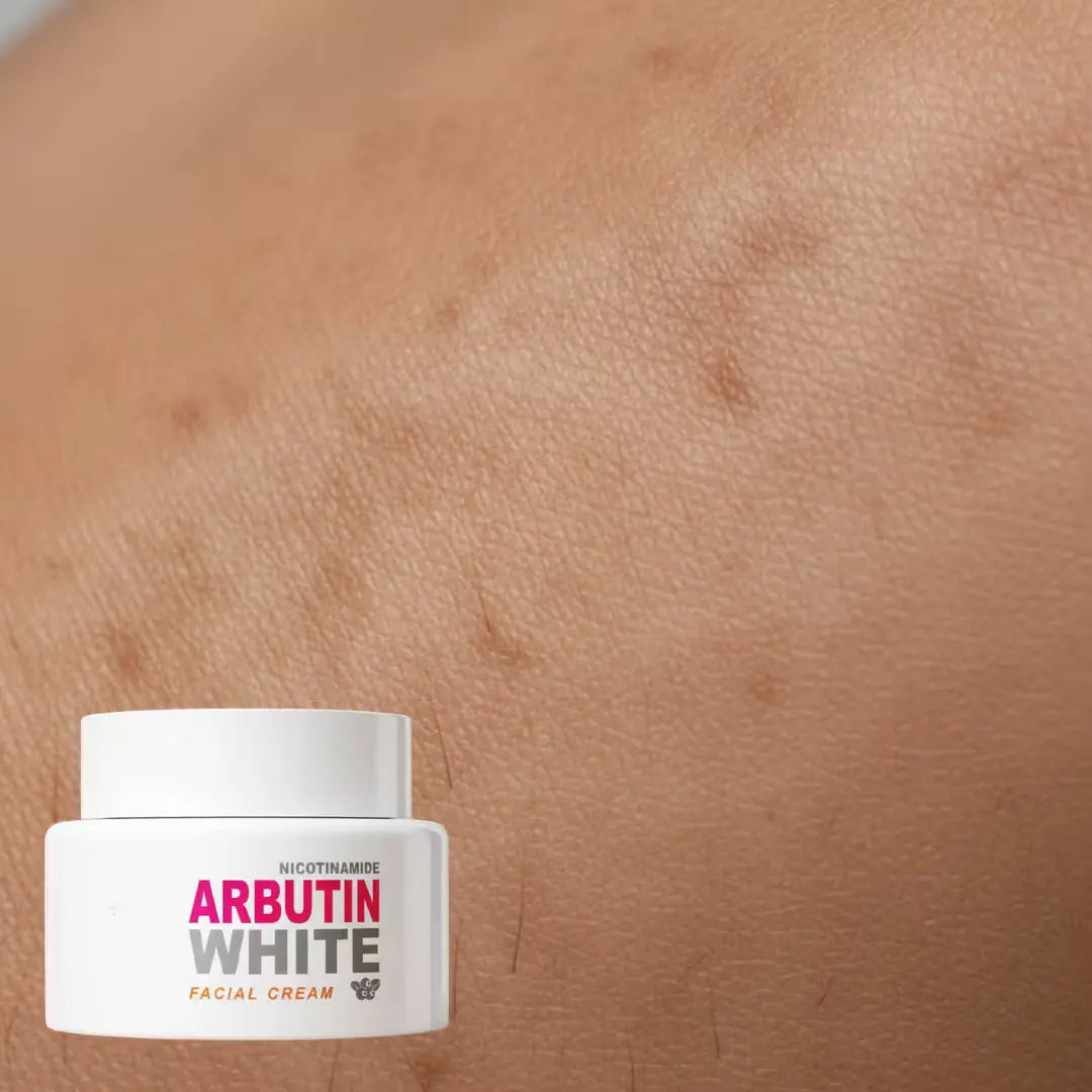 Arbutin White - Crema Aclarante Facial